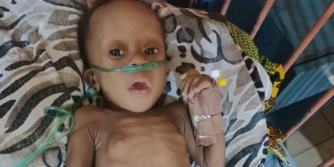 Five-month-old Timothy needs N5.4 million for open-heart surgery