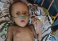 Five-month-old Timothy needs N5.4 million for open-heart surgery