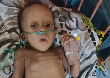 Five-month-old Timothy needs N5.4 million for open-heart surgery